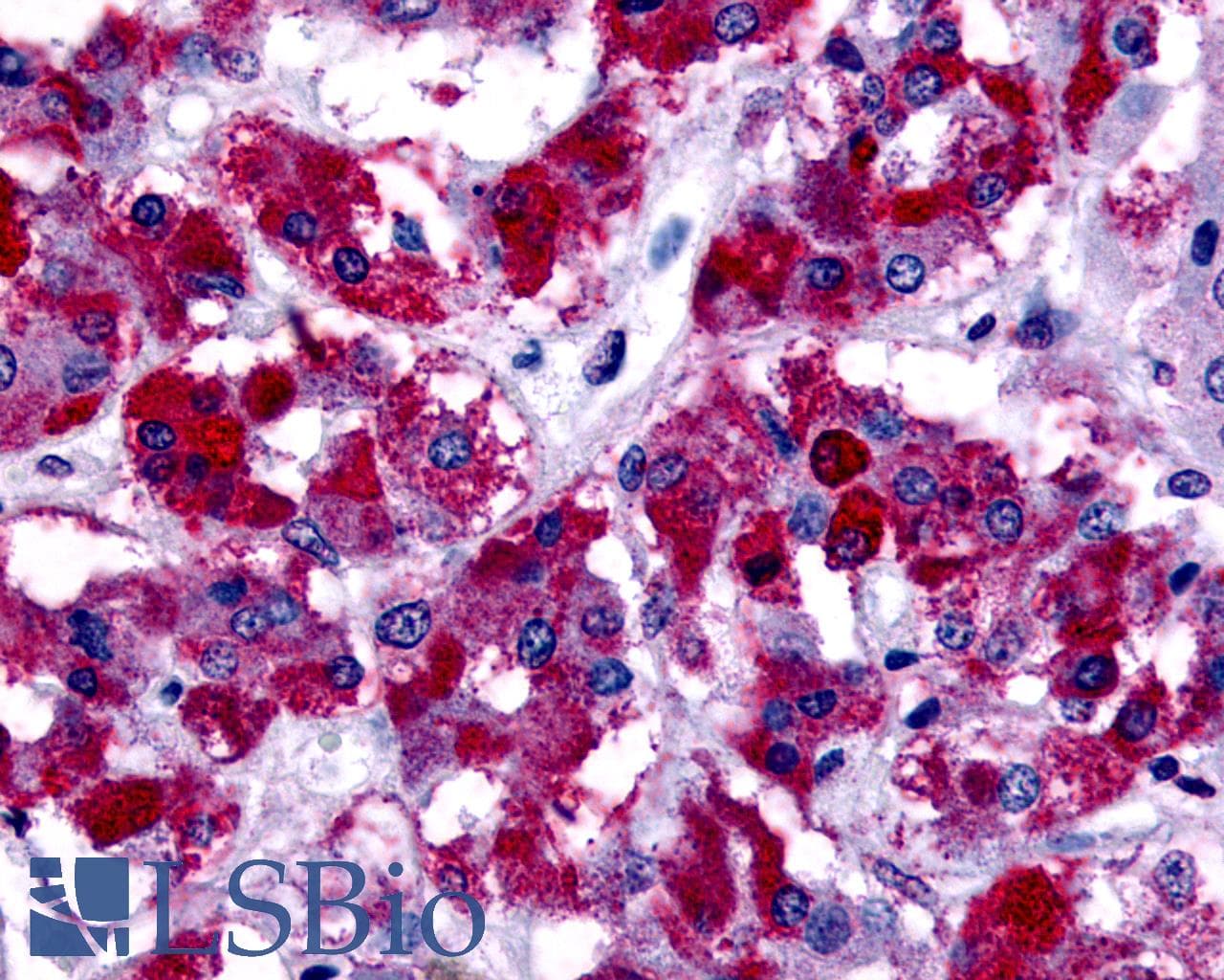 PathPlus™ Polyclonal Rabbit anti-Human GPER1 / GPR30 Antibody (Cytoplasmic Domain, IHC, IF, WB)