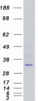 Human CDK6 Protein (Recombinant Myc-DDK (Flag))