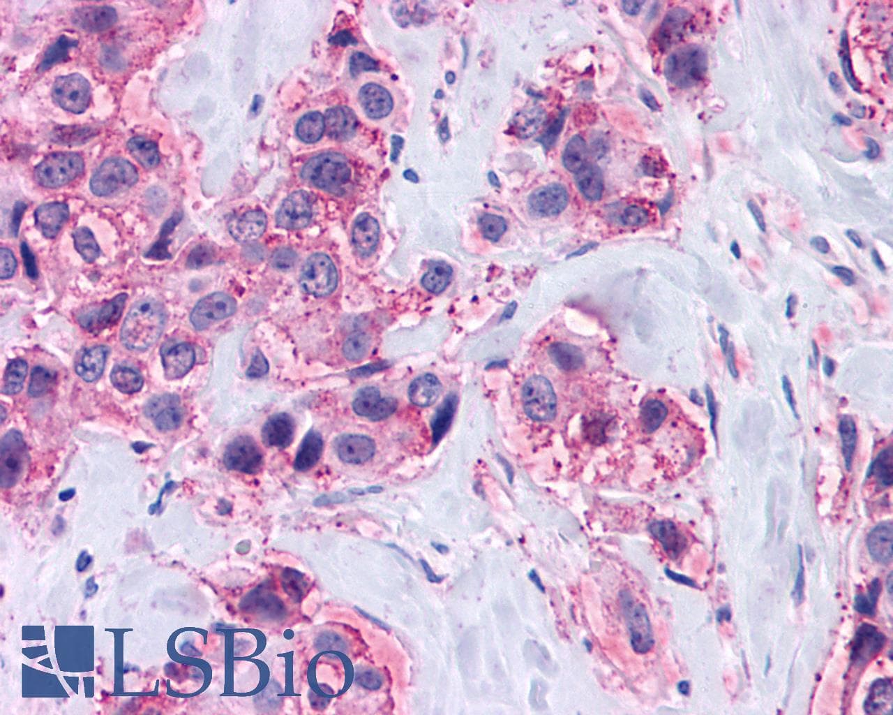 PathPlus™ Polyclonal Rabbit anti-Human MAS1 / MAS Antibody (C-Terminus, IHC)