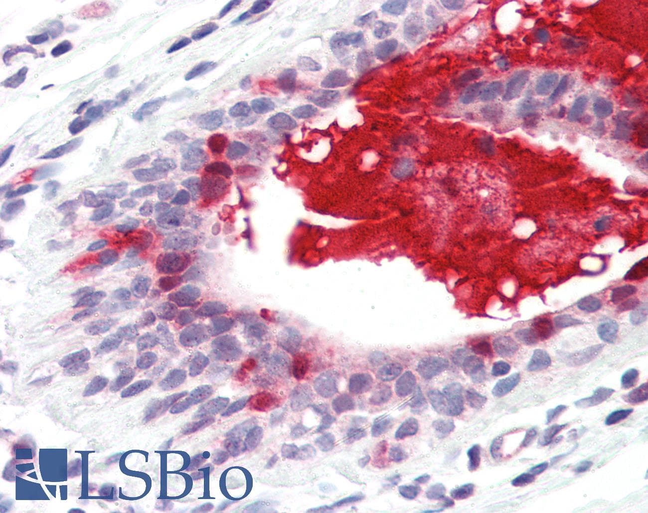 IHC-plus™ TNFSF13 / APRIL Antibody