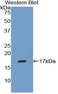 Epsin 1 / EPN1 Antibody (aa279-437, Biotin)