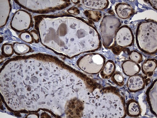 ALDH7A1 Antibody (clone OTI1A9, Carrier-free)