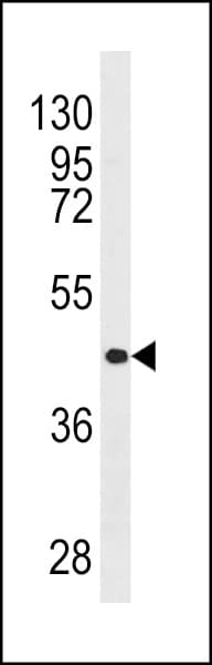 RARB / RAR Beta Antibody (aa160-188)