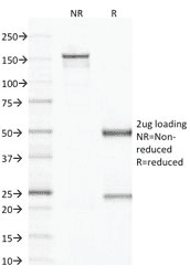 CD79B / CD79 Beta Antibody (clone IGB/1843)
