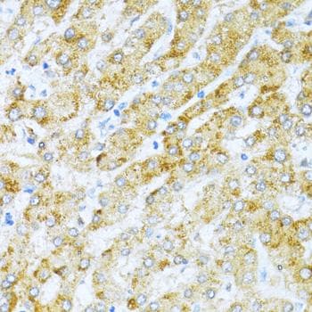 KLHL42 / KLHDC5 Antibody
