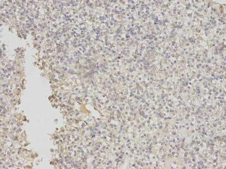 EIF5A Antibody