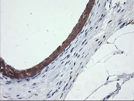 CATIP / C2orf62 Antibody (clone OTI4B4)