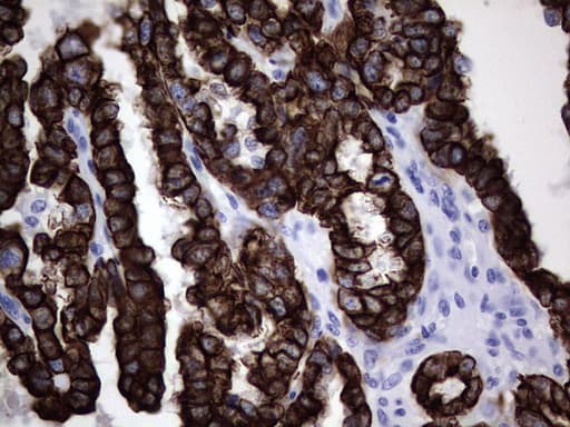IHC-plus™ Acidic Cytokeratin Antibody (clone 1D10)