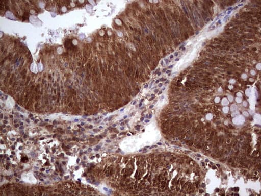 IHC-plus™ Monoclonal Mouse anti-Human LGALS9 / Galectin 9 Antibody (clone 21B5, IHC, WB)