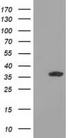 GRHPR / Glyoxylate Reductase Antibody (clone OTI9G2)