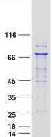 Human PGM2 Protein (Recombinant Myc-DDK (Flag))