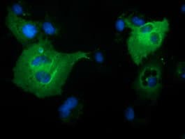 BCAP / PIK3AP1 Antibody (clone OTI5A5)