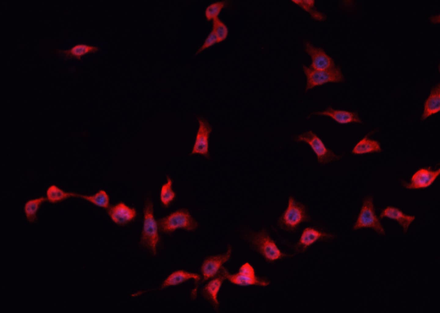 S100A8 / MRP8 Antibody