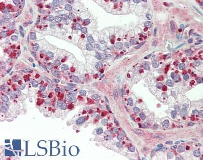 IHC-plus™ Polyclonal Goat anti-Human HUWE1 / ARFBP1 Antibody (aa2250-2300, IHC, WB)