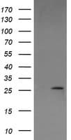 LGALS3 / Galectin 3 Antibody (clone OTI1A3)
