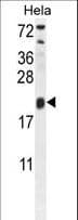 Polyclonal Rabbit anti-Human TRAPPC3 Antibody (aa17-46, WB)