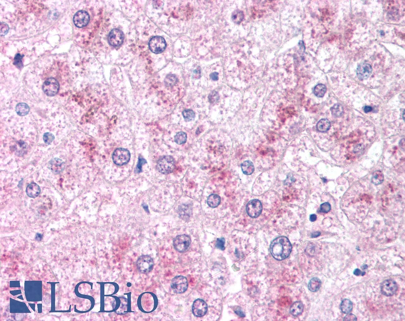 IHC-plus™ Polyclonal Rabbit anti-Human CRADD / RAIDD Antibody (IHC, IF, WB)