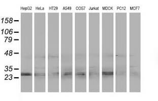 Monoclonal Mouse anti-Human EIF4E2 / IF4e Antibody (clone OTI1C1, IHC, WB)