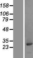 CCDC25 Protein (Over-Expression Lysate Myc-DDK (Flag))