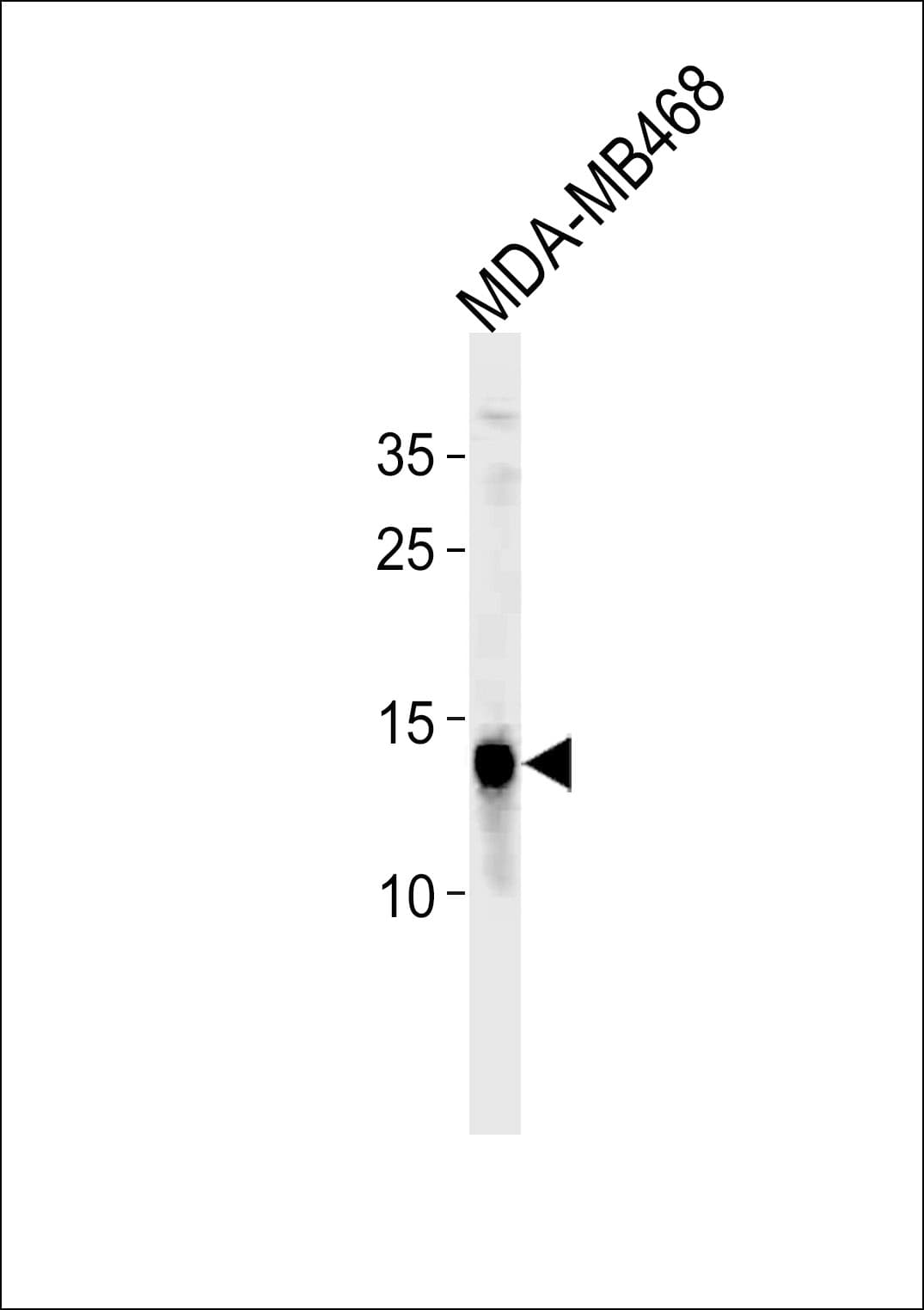 TPD52L3 Antibody (aa10-38)