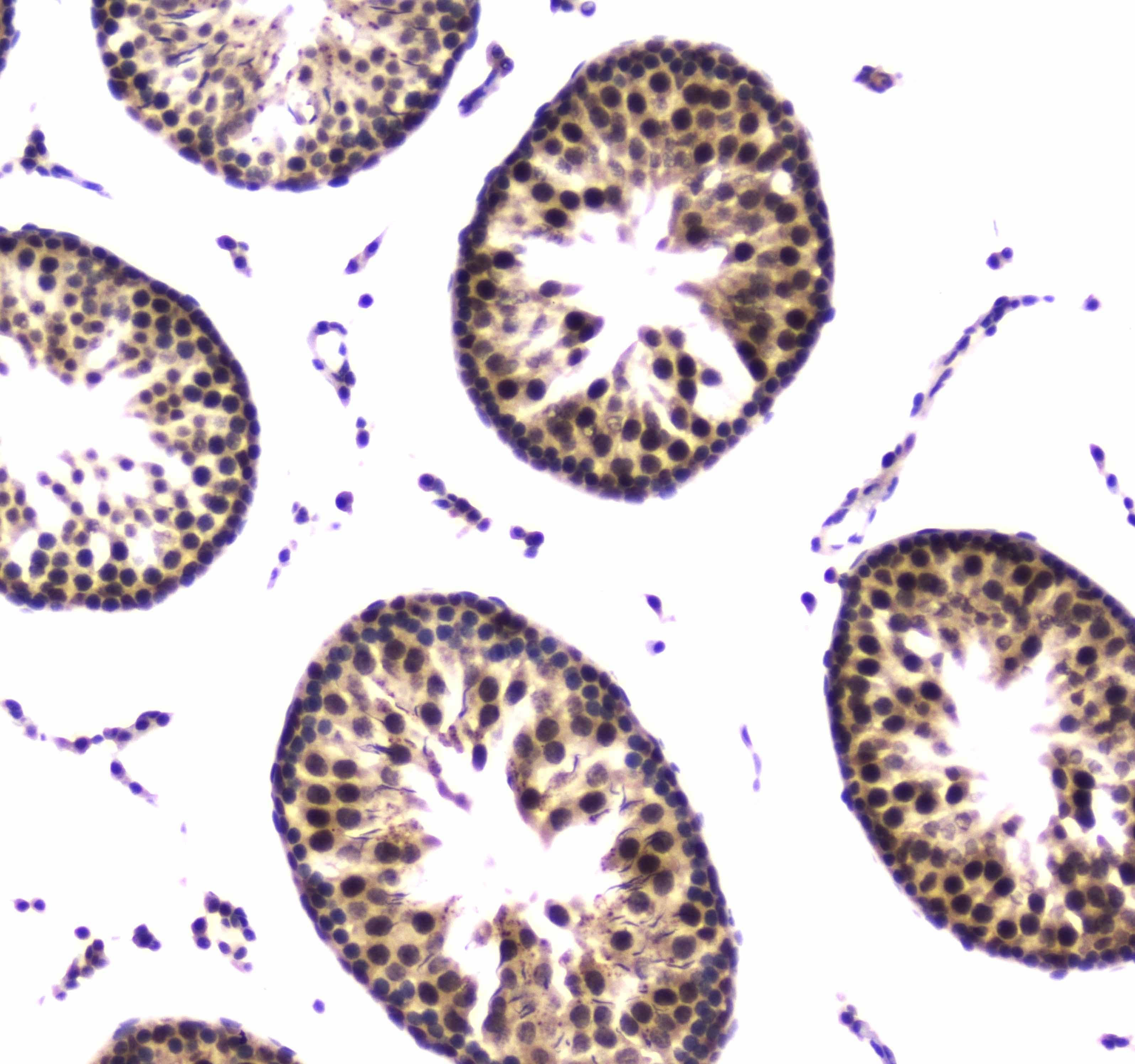 POLR2A / RNA polymerase II Antibody