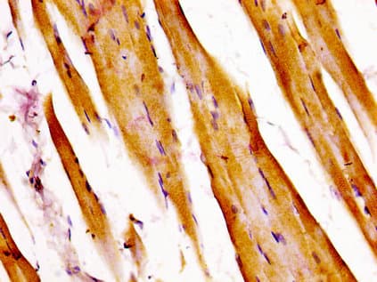 ATXN7 / SCA7 / Ataxin-7 Antibody