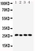 SFTPA1 / Surfactant Protein A Antibody (aa233-248)