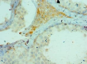CTCFL / BORIS Antibody (aa1-270)