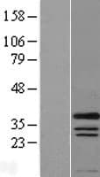 PRX-1 / PRRX1 Protein (Over-Expression Lysate Myc-DDK (Flag))