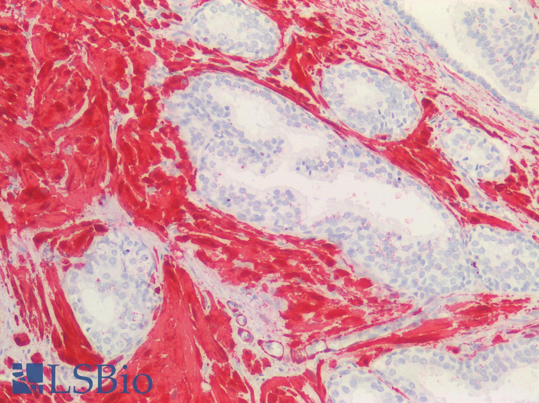 IHC-plus™ TAGLN / Transgelin / SM22 Antibody (aa190-201)
