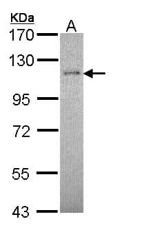 IHC-plus™ RBBP8 / CTIP Antibody