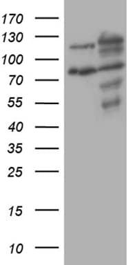 Monoclonal Mouse anti-Human XRN2 Antibody (clone OTI5F4, Carrier-free, aa677-779, IHC, WB)