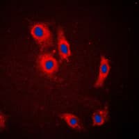 SLC24A1 / NCKX Antibody (Internal)