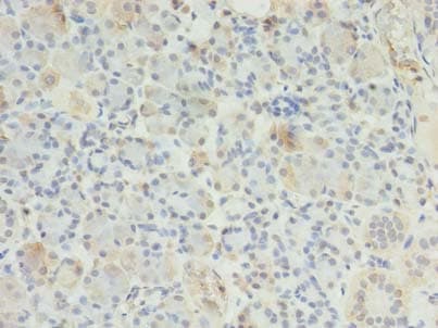 Polyclonal Rabbit anti-Human ERP27 Antibody (IHC)