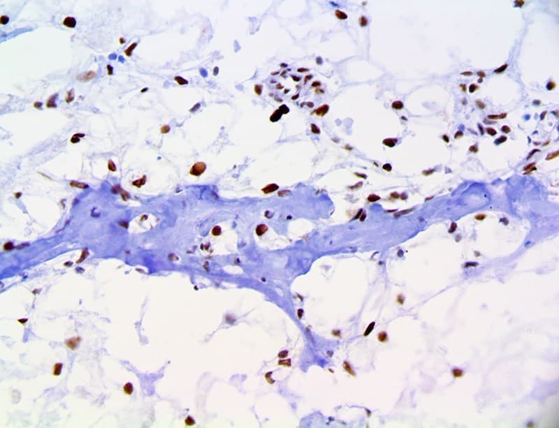 TBX1 Antibody (clone RBT-TBXT, Ready-to-Use)