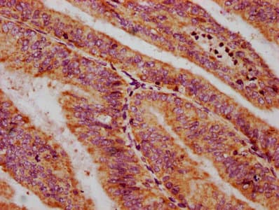 Polyclonal Rabbit anti-Human CXorf36 Antibody (IHC, WB)
