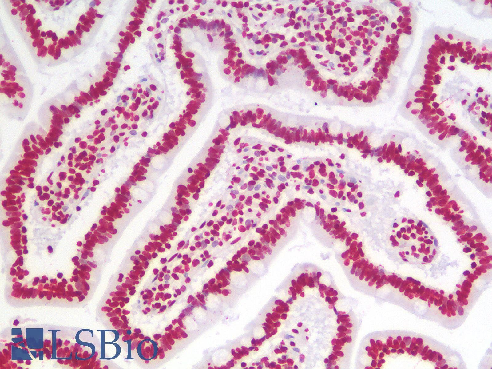 IHC-plus™ Polyclonal Rabbit anti-Mouse HMG1 / HMGB1 Antibody (IHC, IF, WB)