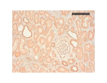 Monoclonal Mouse anti-Human Basic Cytokeratin AE3 Antibody (clone AE3, IHC, WB)
