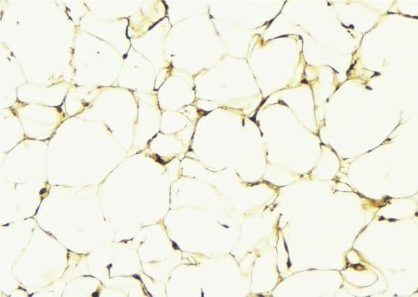 ALDH3B1 Antibody