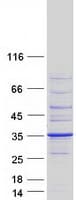 Human BRMS1 Protein (Recombinant Myc-DDK (Flag))