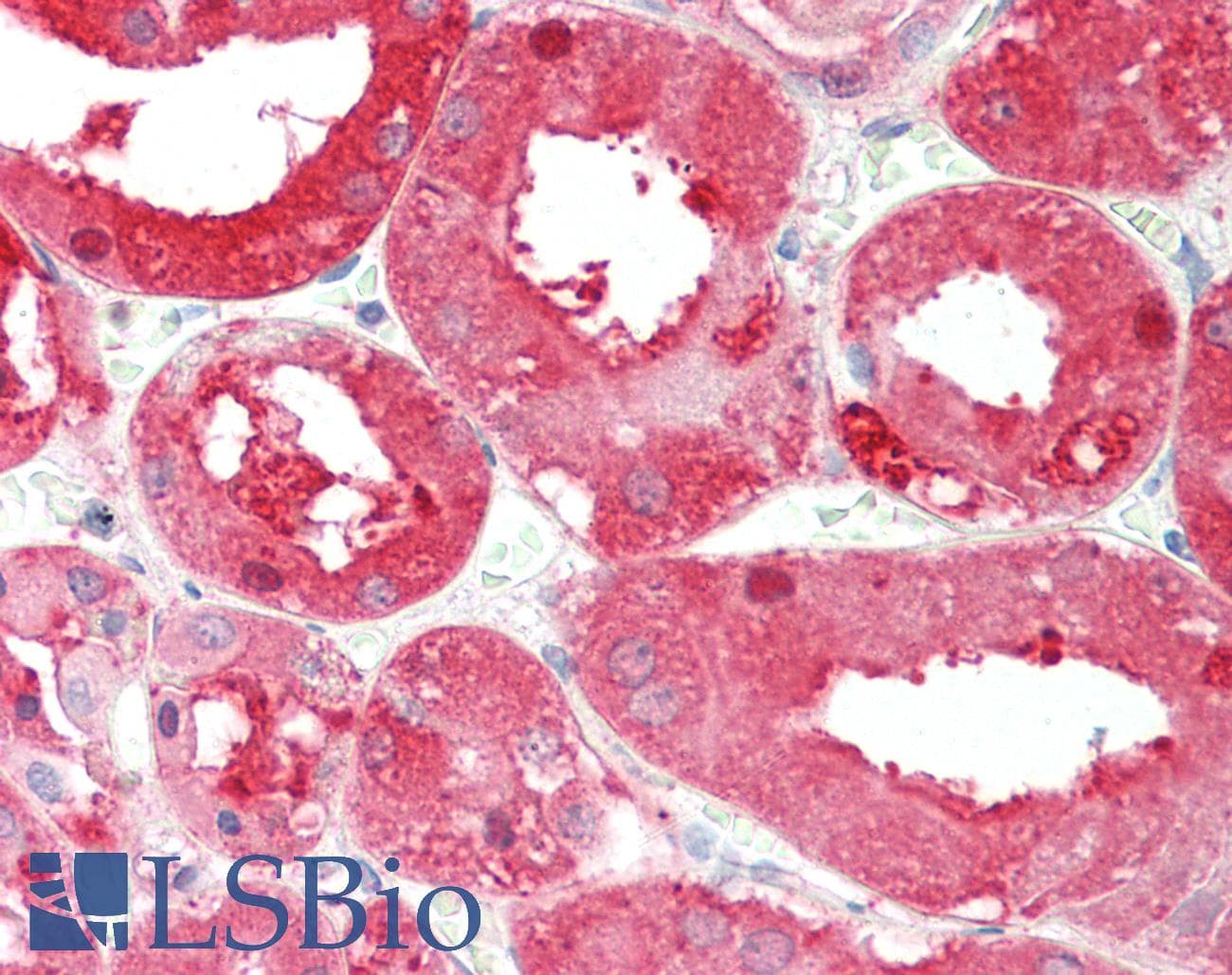 IHC-plus™ ALDH1L1 Antibody