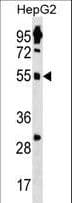 Polyclonal Rabbit anti-Human ZNF500 Antibody (aa28-54, WB)