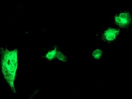 SPINT1 / HAI-1 Antibody (clone OTI4H2)