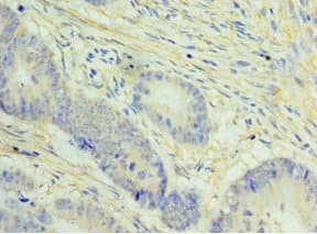 NCAPH / CAP-H Antibody (aa1-250)