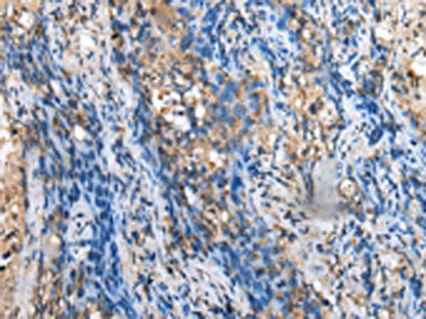 MOB4 / PHOCN Antibody