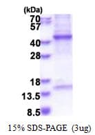 Human HPR Protein (Recombinant His)