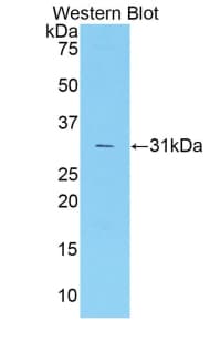 F5 / Factor Va Antibody (aa1776-2028)