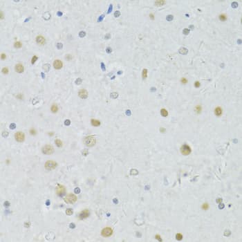 BRCA1 Antibody