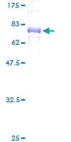 Human KRT23 / Keratin 23 Protein (Recombinant GST)