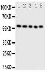 Polyclonal Rabbit anti-Human PDIA3 / ERp57 Antibody (aa172-188, IHC, WB)